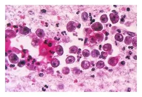  Naegleria Fowleri: ¡Un depredador microscópico que habita en aguas cálidas y puede causar infecciones cerebrales!